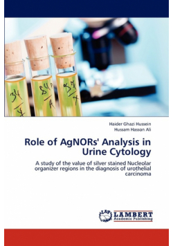 Role of Agnors' Analysis in Urine Cytology