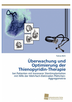 Überwachung und Optimierung der Thienopyridin-Therapie