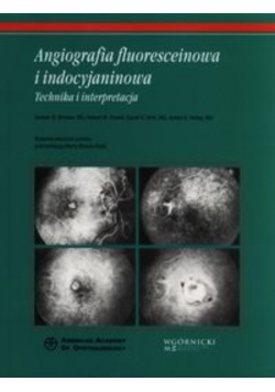 Angiografia fluoresceinowa i indocyjaninowa