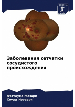 Заболевания сетчатки сосудистого происхождения
