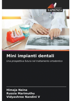 Mini impianti dentali