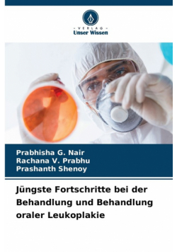 Jüngste Fortschritte bei der Behandlung und Behandlung oraler Leukoplakie