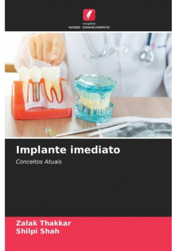 Implante imediato