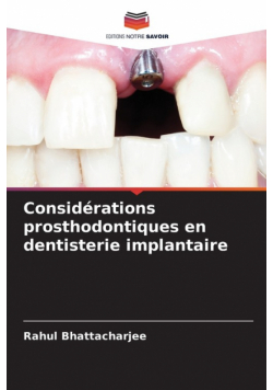 Considérations prosthodontiques en dentisterie implantaire
