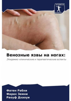 Венозные язвы на ногах