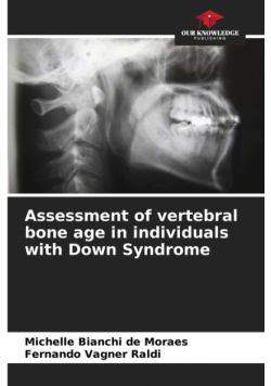 Assessment of vertebral bone age in individuals with Down Syndrome