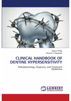 Clinical Handbook Of Dentine Hypersensitivity