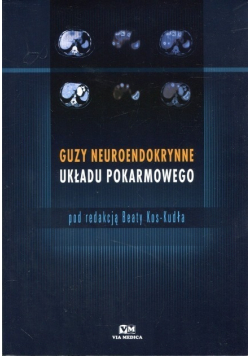 Guzy neuroendokrynne układu pokarmowego