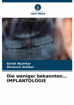 Die weniger bekannten... IMPLANTOLOGIE