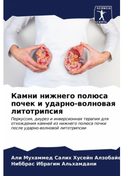 Камни нижнего полюса почек и ударно-волновая литотрипсия