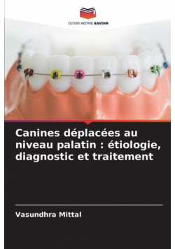 Canines déplacées au niveau palatin