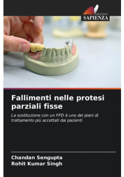 Fallimenti nelle protesi parziali fisse