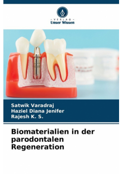 Biomaterialien in der parodontalen Regeneration