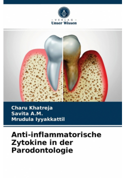 Anti-inflammatorische Zytokine in der Parodontologie