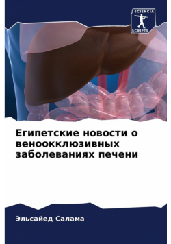 Египетские новости о веноокклюзивных заболеваниях печени