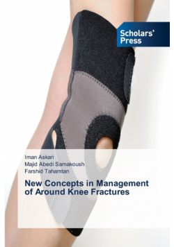 New Concepts in Management of Around Knee Fractures