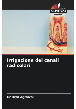 Irrigazione dei canali radicolari