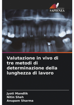 Valutazione in vivo di tre metodi di determinazione della lunghezza di lavoro