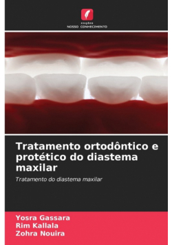 Tratamento ortodôntico e protético do diastema maxilar