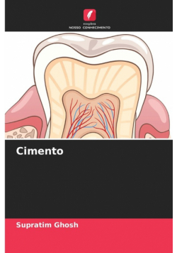 Cimento