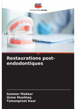 Restaurations post-endodontiques