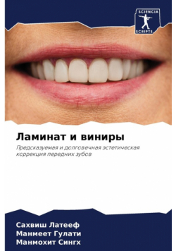 Ламинат и виниры