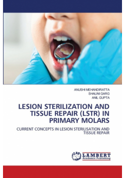 Lesion Sterilization And Tissue Repair (Lstr) In Primary Molars