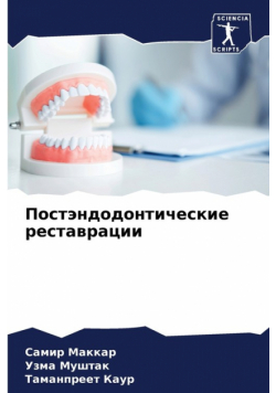 Постэндодонтические реставрации
