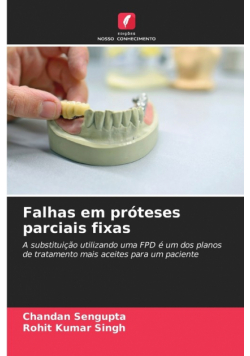 Falhas em próteses parciais fixas