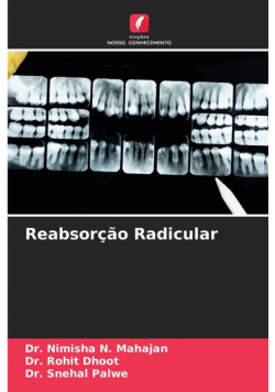 Reabsorção Radicular