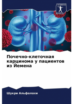 Почечно-клеточная карцинома у пациентов из Йемена