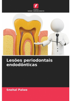 Lesões periodontais endodônticas