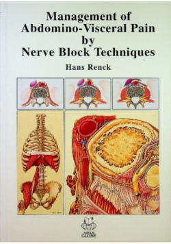 Management of Abdomino Visceral Pain by Nerve Block Techniques