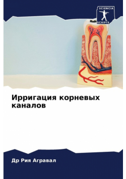 Ирригация корневых каналов