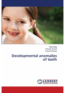 Developmental anomalies of teeth