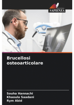 Brucellosi osteoarticolare