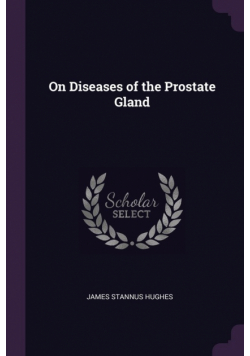 On Diseases of the Prostate Gland