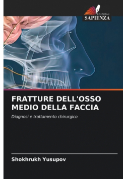 Fratture Dell'osso Medio Della Faccia