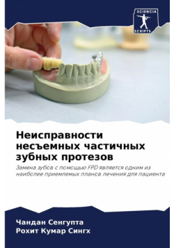 Неисправности несъемных частичных зубных протезов
