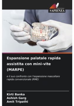 Espansione palatale rapida assistita con mini-vite (MARPE)
