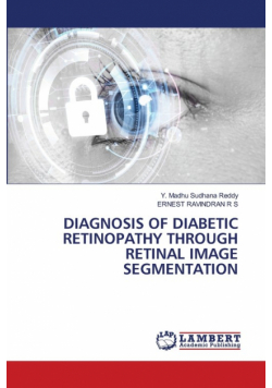 Diagnosis Of Diabetic Retinopathy Through Retinal Image Segmentation