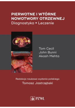 Pierwotne i wtórne nowotwory otrzewnej