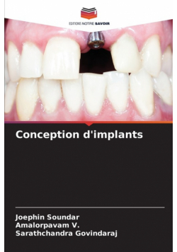 Conception d'implants