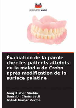 Évaluation de la parole chez les patients atteints de la maladie de Crohn après modification de la surface palatine