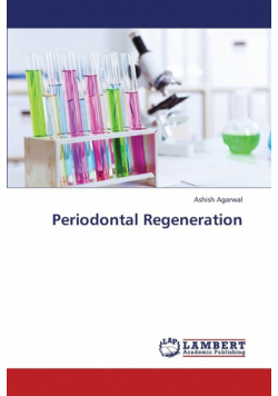 Periodontal Regeneration