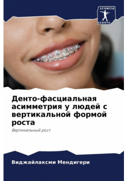 Денто-фасциальная асимметрия у людей с вертикальной формой роста