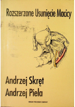 Rozszerzone usunięcie macicy