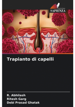 Trapianto di capelli
