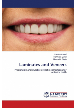 Laminates and Veneers