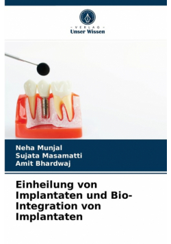 Einheilung von Implantaten und Bio- Integration von Implantaten